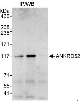 ANKRD52 Antibody