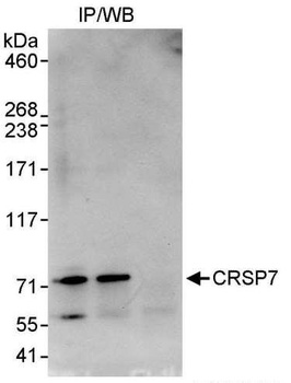 Rabbit anti-CRSP7 Antibody