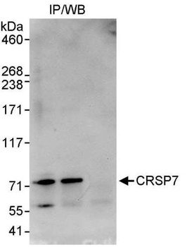 Rabbit anti-CRSP7 Antibody