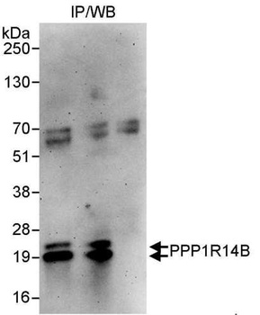 Rabbit anti-PPP1R14B Antibody