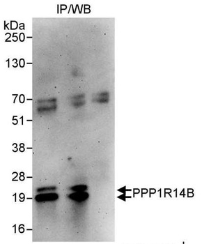 Rabbit anti-PPP1R14B Antibody
