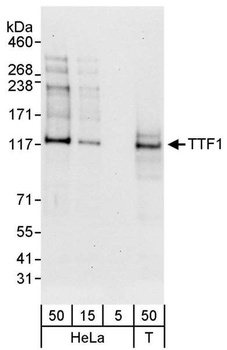 TTF1 Antibody