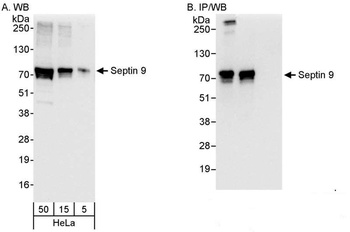Rabbit anti-Septin 9 Antibody