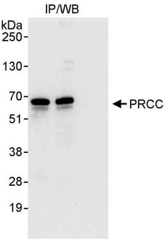 PRCC Antibody