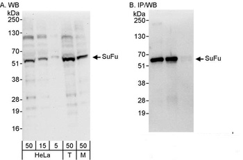 Rabbit anti-SuFu Antibody