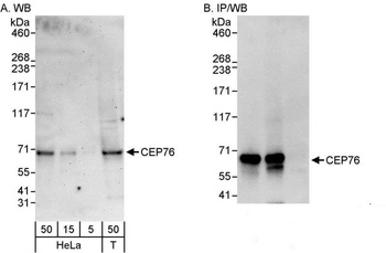 Rabbit anti-CEP76 Antibody