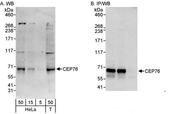 Rabbit anti-CEP76 Antibody