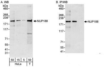 NUP188 Antibody