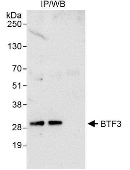 BTF3 Antibody