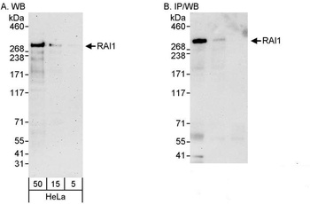 Rabbit anti-RAI1 Antibody