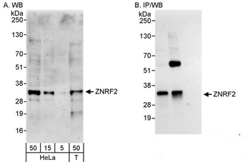 Rabbit anti-ZNRF2 Antibody