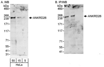 Rabbit anti-ANKRD26 Antibody
