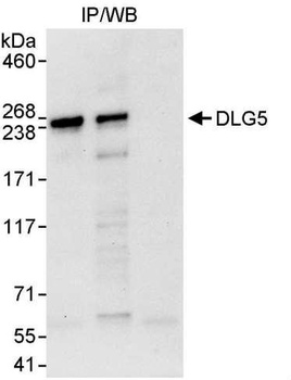 Rabbit anti-DLG5 Antibody