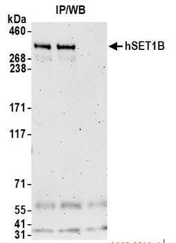 hSET1B Antibody