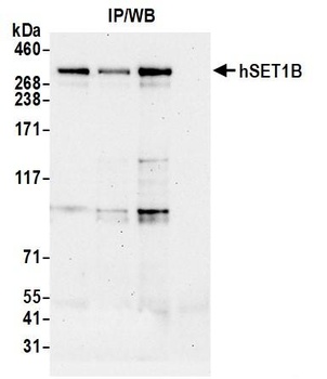 Rabbit anti-hSET1B Antibody