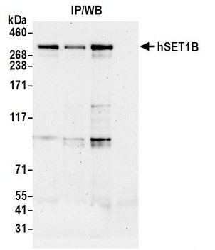 hSET1B Antibody