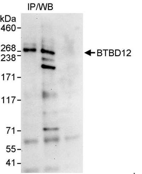 Rabbit anti-BTBD12 Antibody