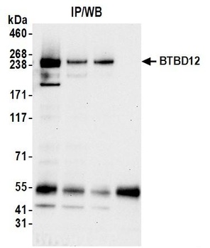 Rabbit anti-BTBD12 Antibody