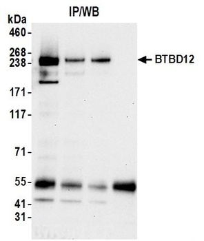 BTBD12 Antibody