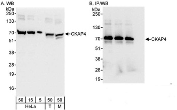 Rabbit anti-CKAP4 Antibody
