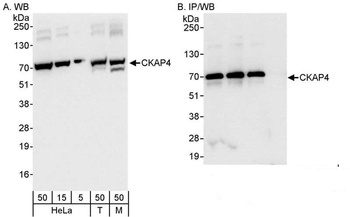 Rabbit anti-CKAP4 Antibody