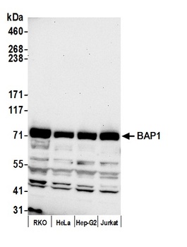 Rabbit anti-BAP1 Antibody
