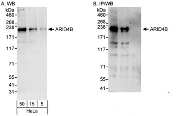 ARID4B Antibody