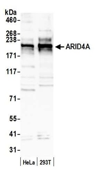 Rabbit anti-ARID4A Antibody