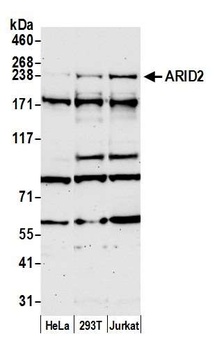 Rabbit anti-ARID2 Antibody