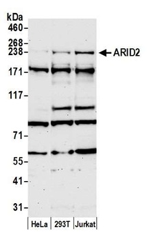 ARID2 Antibody