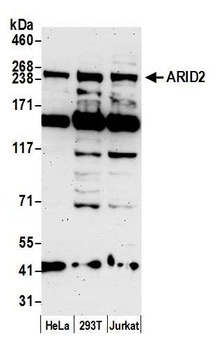 ARID2 Antibody