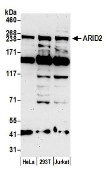 Rabbit anti-ARID2 Antibody