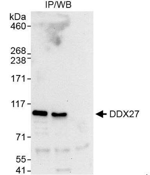 DDX27 Antibody