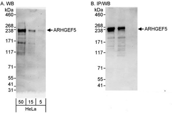 Rabbit anti-ARHGEF5 Antibody