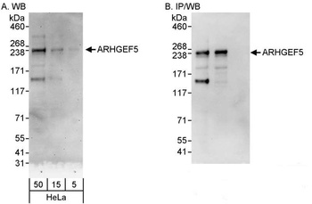 Rabbit anti-ARHGEF5 Antibody