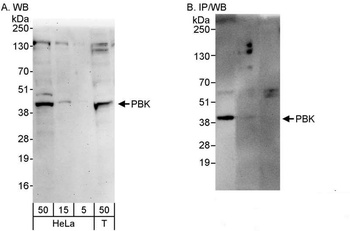 Rabbit anti-PBK Antibody