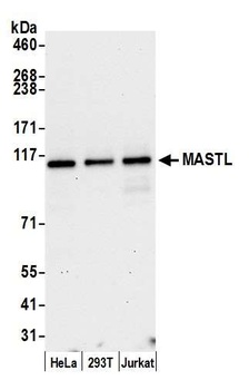 Rabbit anti-MASTL Antibody