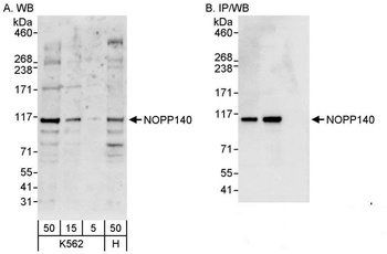 NOPP140 Antibody