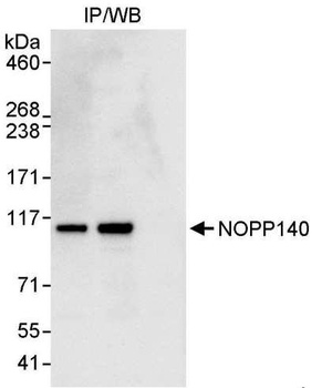 NOPP140 Antibody