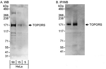 Rabbit anti-TOPORS Antibody