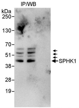 SPHK1 Antibody