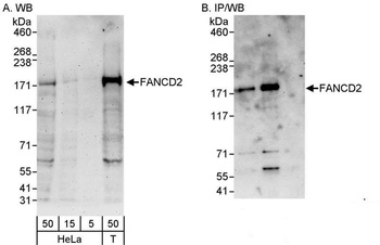 Rabbit anti-FANCD2 Antibody