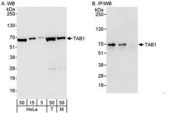 TAB1 Antibody