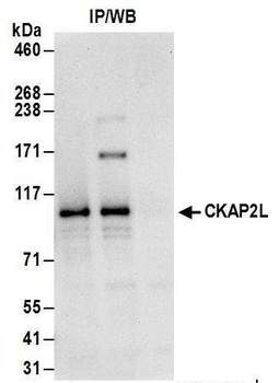 CKAP2L Antibody