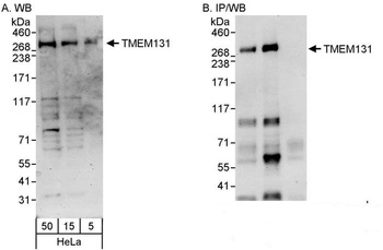 TMEM131 Antibody