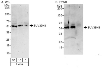 Rabbit anti-SUV39H1 Antibody