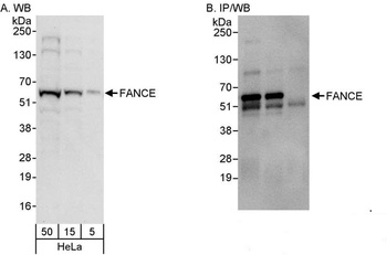 Rabbit anti-FANCE Antibody