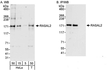 Rabbit anti-RASAL2 Antibody