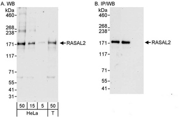 RASAL2 Antibody