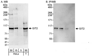 Rabbit anti-GIT2 Antibody